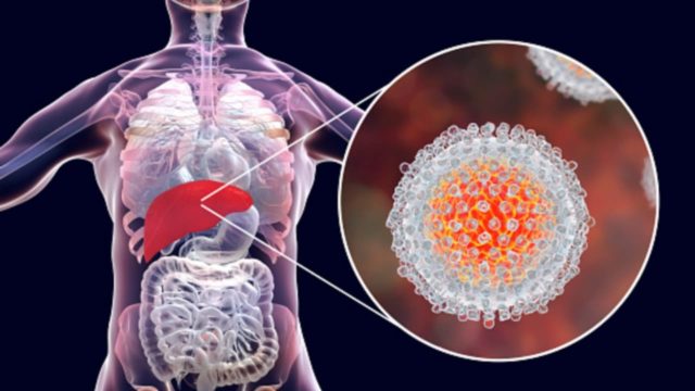 Descubren cómo el virus de la Hepatitis C causa infección crónica "burlando" al sistema inmunológico